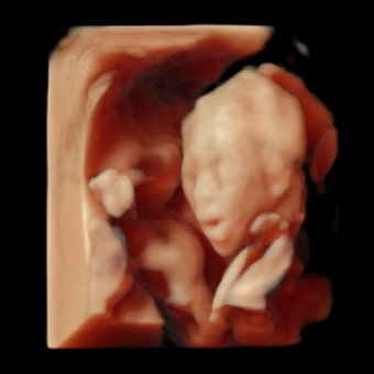 Babylist Registry Photo.