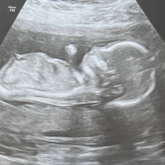 Babylist Registry Photo.