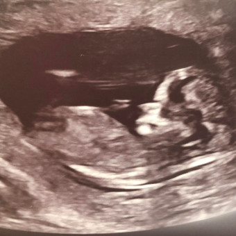 Babylist Registry Photo.