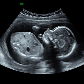 Babylist Registry Photo.