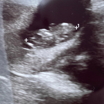 Babylist Registry Photo.