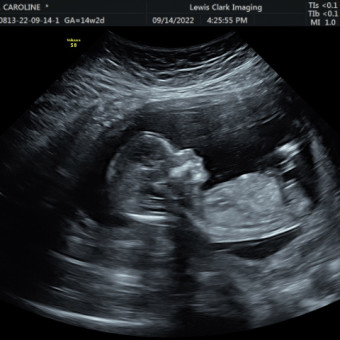 Babylist Registry Photo.
