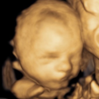 Babylist Registry Photo.