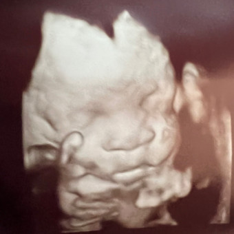Babylist Registry Photo.