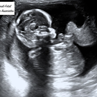 Babylist Registry Photo.