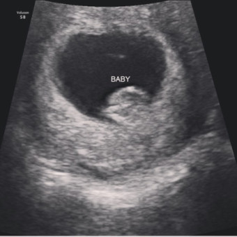 Babylist Registry Photo.