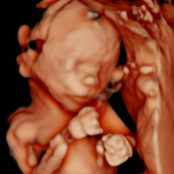 Babylist Registry Photo.