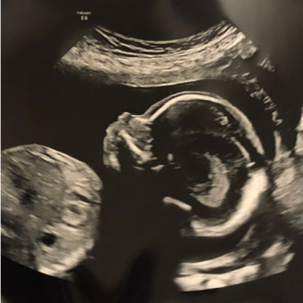 Babylist Registry Photo.