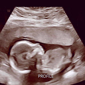 Babylist Registry Photo.