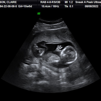 Babylist Registry Photo.