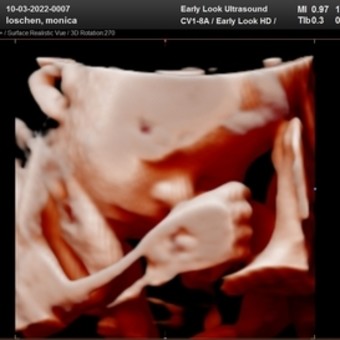 Babylist Registry Photo.