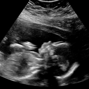 Babylist Registry Photo.
