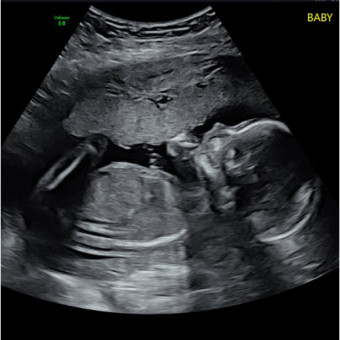 Babylist Registry Photo.