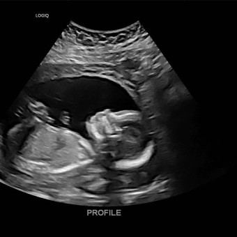 Babylist Registry Photo.