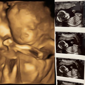 Babylist Registry Photo.
