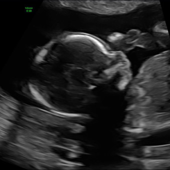 Babylist Registry Photo.