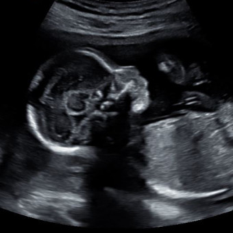 Babylist Registry Photo.