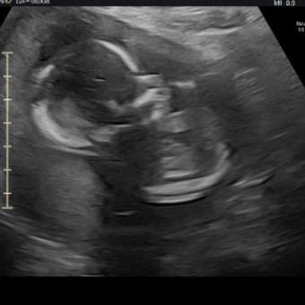 Babylist Registry Photo.