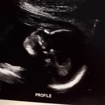 Babylist Registry Photo.