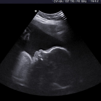 Babylist Registry Photo.