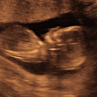 Babylist Registry Photo.