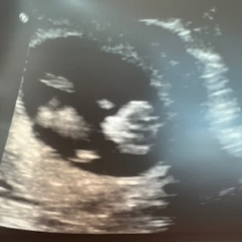 Babylist Registry Photo.
