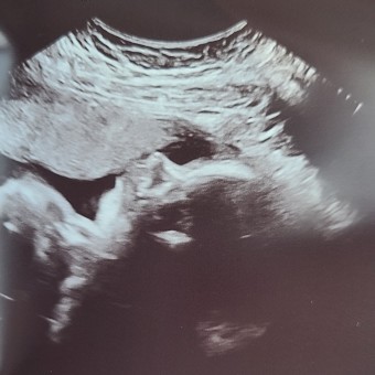 Babylist Registry Photo.
