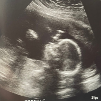 Babylist Registry Photo.
