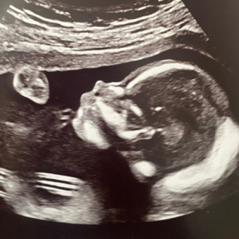 Babylist Registry Photo.