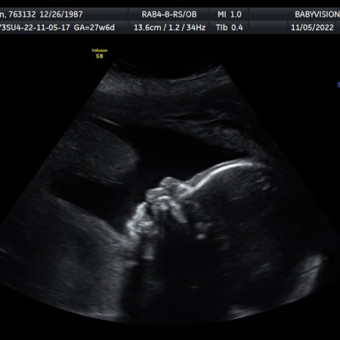 Babylist Registry Photo.