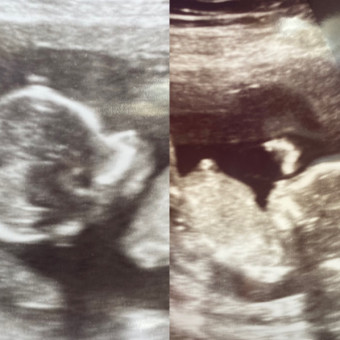 Babylist Registry Photo.