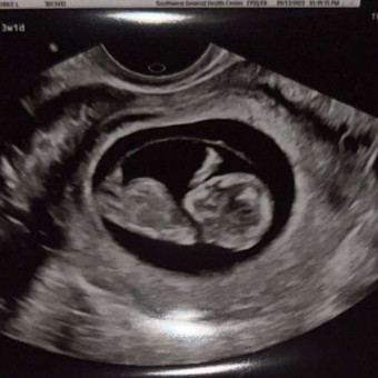 Babylist Registry Photo.