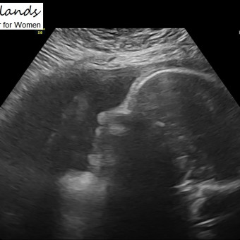 Babylist Registry Photo.