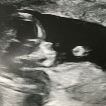 Babylist Registry Photo.