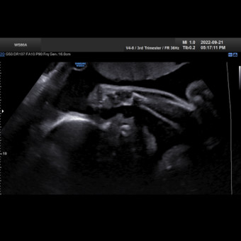 Babylist Registry Photo.