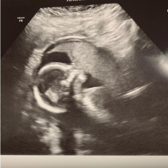 Kendra and Dalton’s Baby Registry Photo.