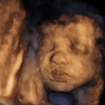 Lyndsay and Riley’s Baby Registry Photo.
