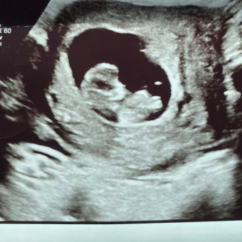 Babylist Registry Photo.
