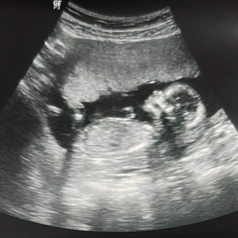Babylist Registry Photo.