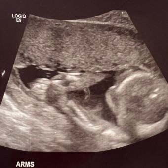 Babylist Registry Photo.