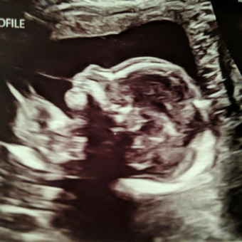 Babylist Registry Photo.