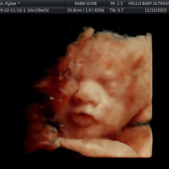 Babylist Registry Photo.