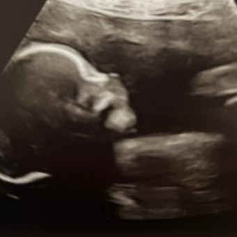 Babylist Registry Photo.