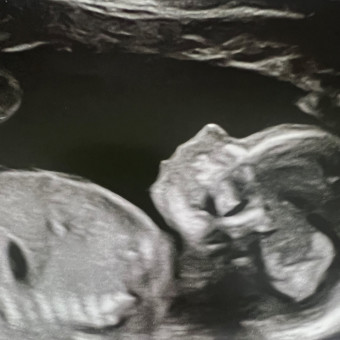 Babylist Registry Photo.