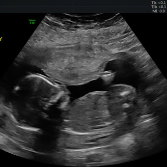 Lauren's Baby Registry Photo.
