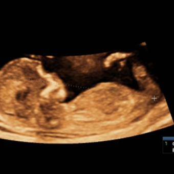 Babylist Registry Photo.
