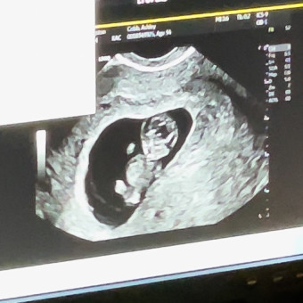 Babylist Registry Photo.