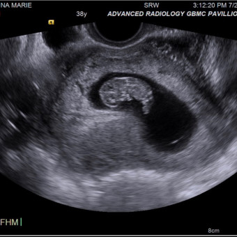 Babylist Registry Photo.