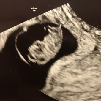 Babylist Registry Photo.