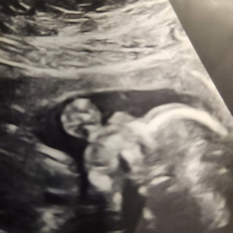 Babylist Registry Photo.